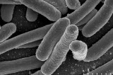 U.S. Syphilis Cases in Newborns Continue to Increase: A 10-Times Increase Over a Decade U.S. Syphilis Cases in Newborns Continue to Increase: A 10-Times Increase Over a Decade