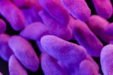 Germs with Unusual Antibiotic Resistance Widespread in U.S.