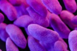 Germs with Unusual Antibiotic Resistance Widespread in U.S. Germs with Unusual Antibiotic Resistance Widespread in U.S.