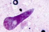 Disease Affecting Cattle Detected in Tennessee Disease Affecting Cattle Detected in Tennessee